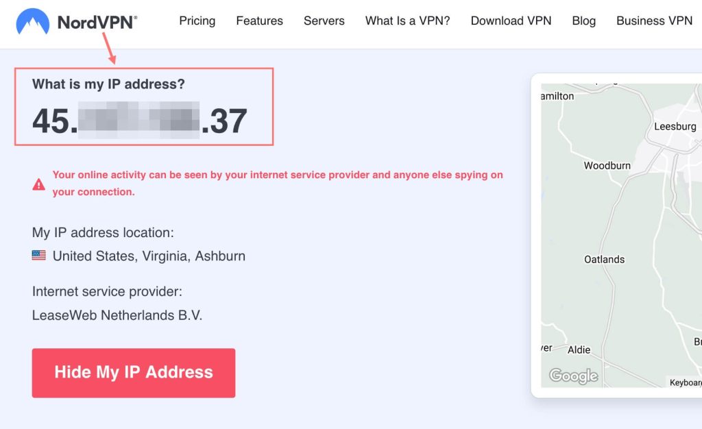 Detect your IP address